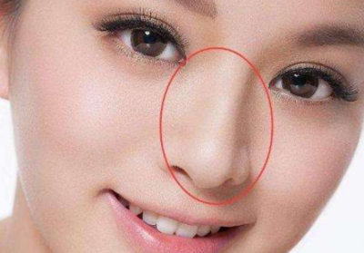 人的鼻子为什么是软骨