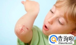 孩子在幼儿园受伤谁来负责？