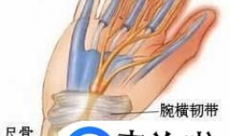 患有鼠标手应该怎么治疗