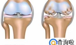 胶原软骨素钙片的作用和适用人群