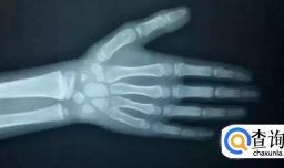 孩子过快成长会产生哪些影响？