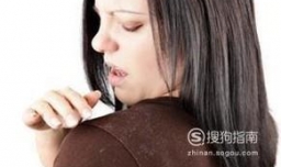头发怎么去屑妙招