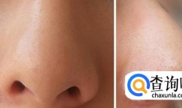 如何收缩脸部毛孔，紧致肌肤