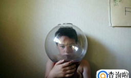 自闭症的病因是什么