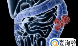 哪些癌症会遗传给后代？