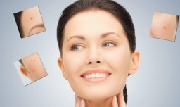 过了青春期还会长痤疮吗