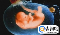 羊水过多需要注意吗？有什么症状？