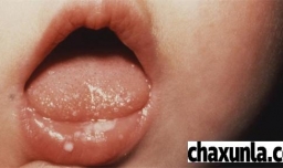为什么儿童嘴唇发白