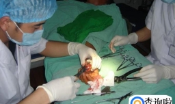 做痔疮手术的注意事项