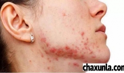 用生理盐水敷脸的坏处有哪些