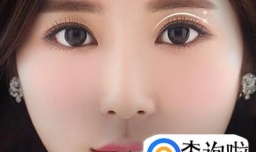 双眼皮手术不得不做的5大理由有哪些？