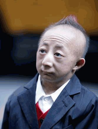 世界上最小的人