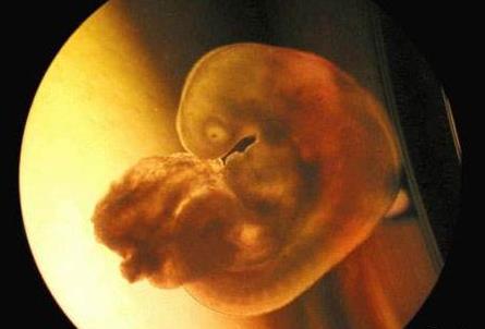 为什么一些鱼类的特征会出现在人体胚胎中