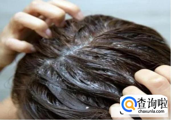 头中间为什么有头皮