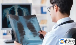 什么情况需要做肺部CT