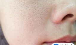 做什么你才能拥有细腻的皮肤呢