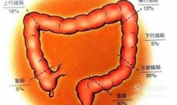 如何定义肠癌 肠癌病人吃哪些食物好