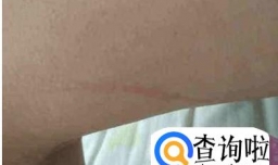 让狗抓了下红了怎么办