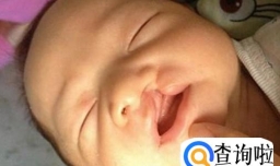 如何预防胎儿畸形？