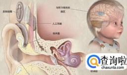 助听器和人工耳蜗的区别
