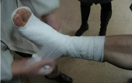 高考前三个月骨折怎么办