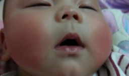 宝宝脸红怎么回事