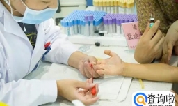 个子矮小去医院检查什么