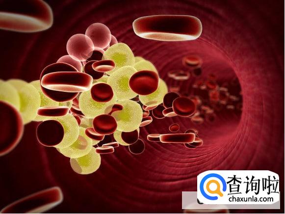 瘦人不会高血脂吗