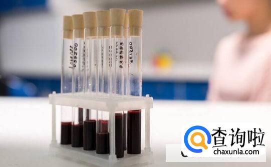 验什么血可以看胃病