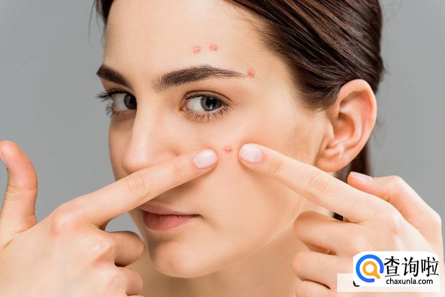 为什么有些人不长痘