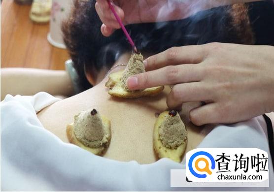 艾灸小腹会排出瘀血吗