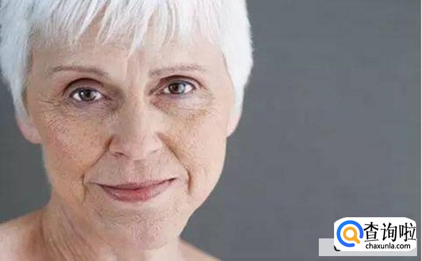 预防老年斑的最好方法