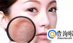 解析女生脸上毛孔粗大怎么办