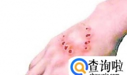 吸毒者初期的症状