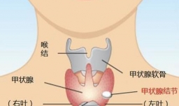 如何定义甲状腺癌 甲状腺癌的早期症状有哪些