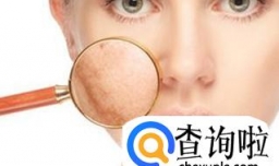 冬天脸上长痘痘的原因