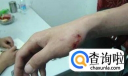 破伤风的病因有哪些