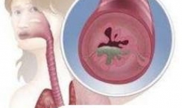 哪些疾病容易导致非心源性猝死