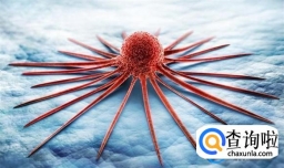 癌症早期症状有哪些？ 癌症早期怎么能发现？