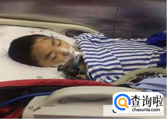 小儿煤气中毒的急救措施？