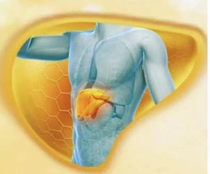脂肪肝最好的治疗方法