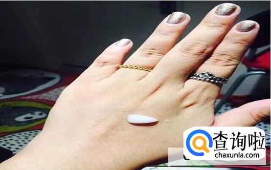 戒指卡手了怎么办
