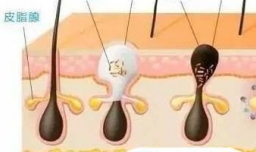 怎样用维生素B6去闭口