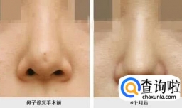 怎样积极面对整容失败？