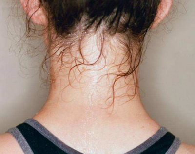 出汗的好处与坏处