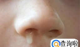 小孩总是流黄鼻涕是怎么回事？