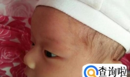 脸上长出红色的痘痘怎么办？