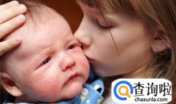 婴儿干性湿疹的预防与治疗