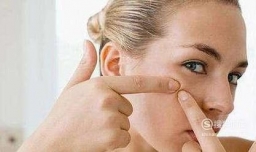 怎样去除脸上的粉刺 白头粉刺