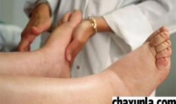 出现水肿的原因